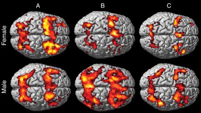 Working Memory Functional Activation