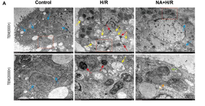 TRANSMISSION ELECTRON MICROSCOPY IMAGES SHOWING MITOCHONDRIAL ULTRASTRUCTURE IN CONTROL, HYPOXIA/REOXYGENATION (H/R), AND NICOTINIC ACID–TREATED HEPATOCYTES