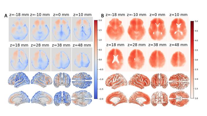 Maps of local brain aging generated by new deep learning model