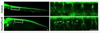 Researchers find a new pathological mediator of ALS