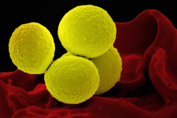 <i>Staphylococcus aureus</i>