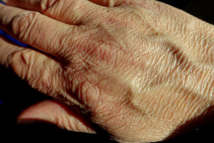 Wrinkled hand
