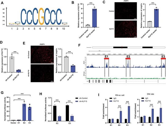 KLF15 enriches at Jmjd1c-SE and promotes the expression of Jmjd1c.