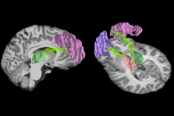 High School Football and the Brain