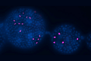Ovariole of female fruit fly