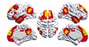 Representation of the connectivity strengths within the brain's Default Mode Network