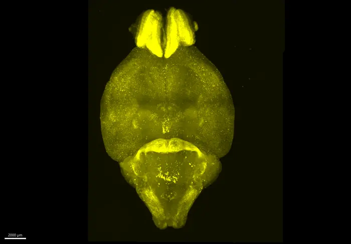 Active neurons glow in this microscope image of a mouse brain