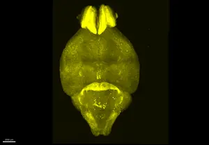 Active neurons glow in this microscope image of a mouse brain