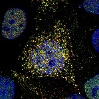 A Cell Infected with Influenza A/WSN/1933 (H1N1) Virus