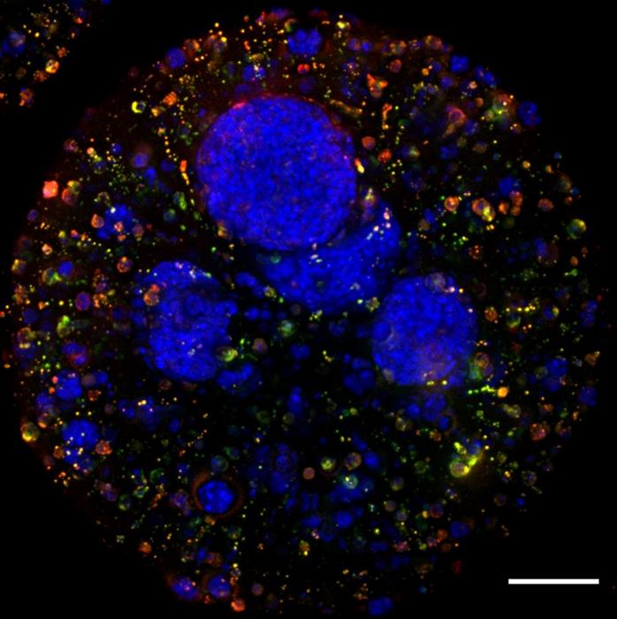 Tumor microenvironment models encapsulated in alginate.
