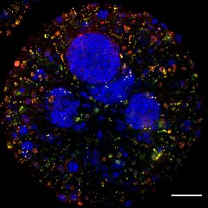 Tumor microenvironment models encapsulated in alginate.