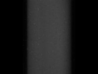Mimicking Pulmonary Edema With a Lung-on-a-Chip (4 of 5)