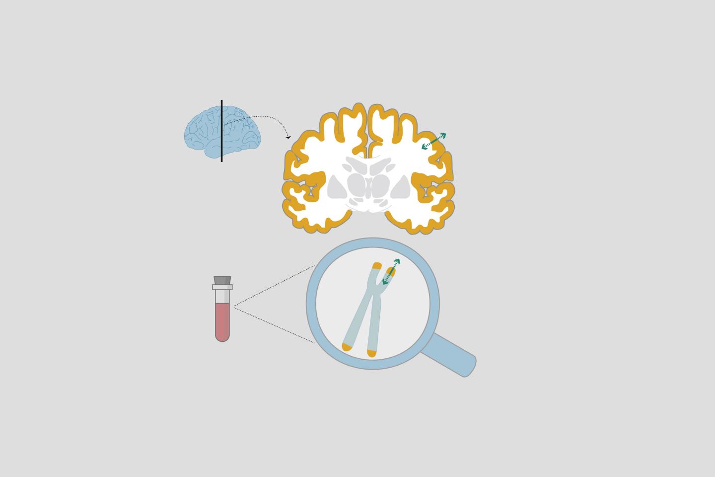 Telomeres on Human Chromosomes Change Together with Brain Structure