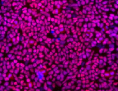 Neural Stem Cells