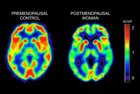 Brain Scan