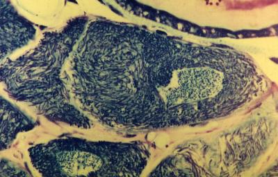 How Beetles Keep Bacteria in Check (1 of 15)