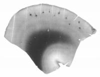 Neurons in the Human Brain