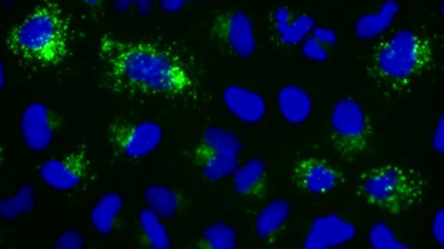 New Drug Squashes Cancer's Last-Ditch Efforts to Survive (2 of 2)