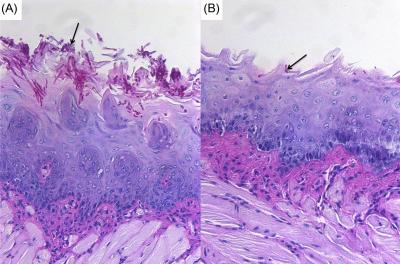 Tissue Invasion by <em>Candida</em>