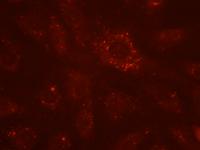 Aggregates -- Treatment