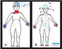Before/After Body Maps