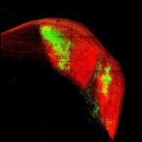 Nerve fibers