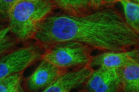 Metastatic Cells