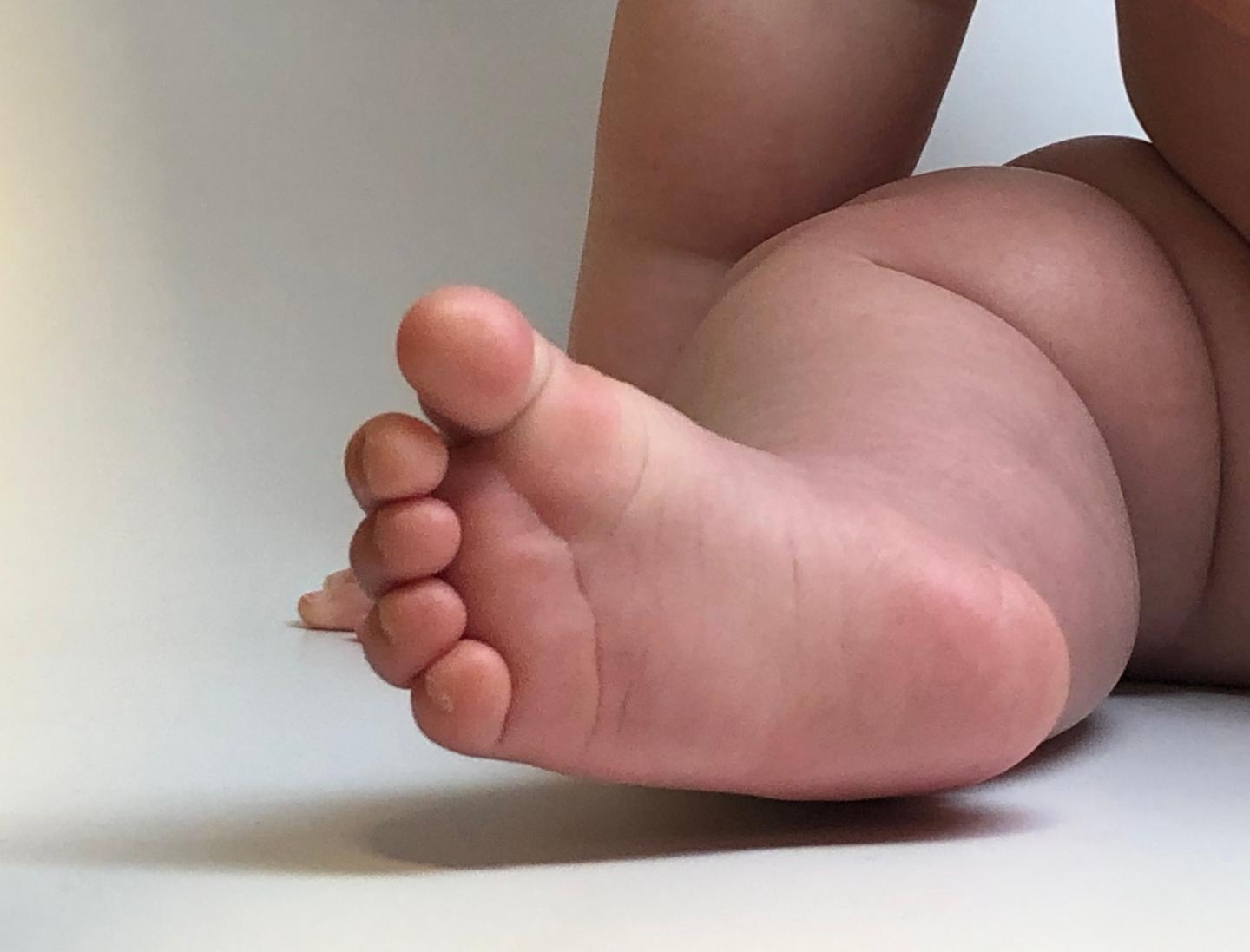 A Baby's Foot and Leg