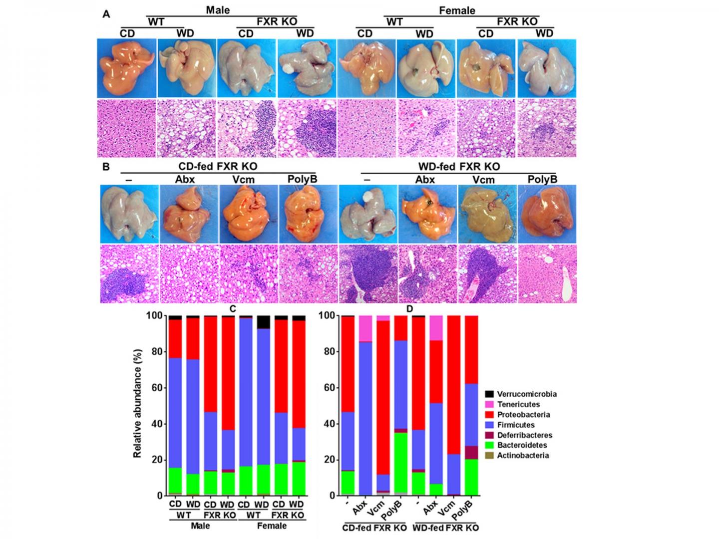 Chronic Liver Inflammation Linked to Western Diet