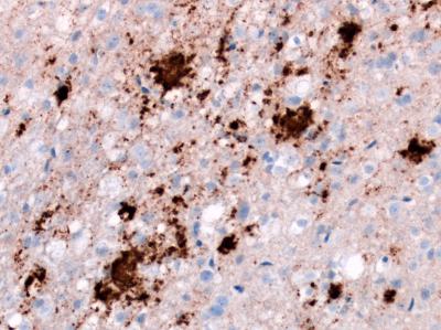 Cell Stain