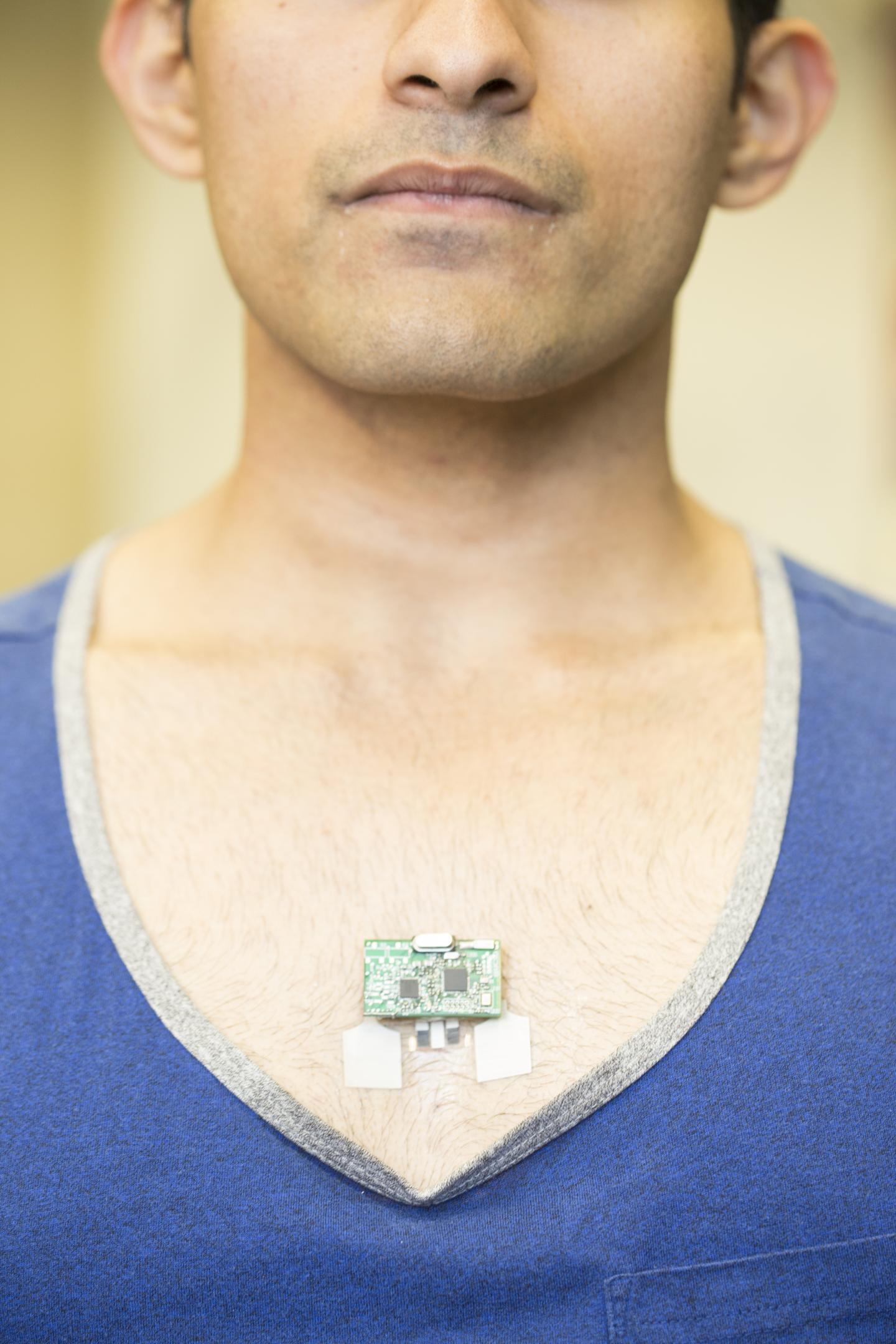 ChemPhys Patch Worn on the Chest