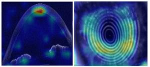 Example of OCT scan of eye used by AI