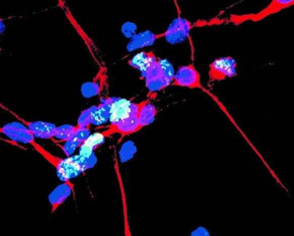 Dopamine Neurons