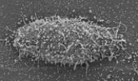 Neutrophil (1 of 2)