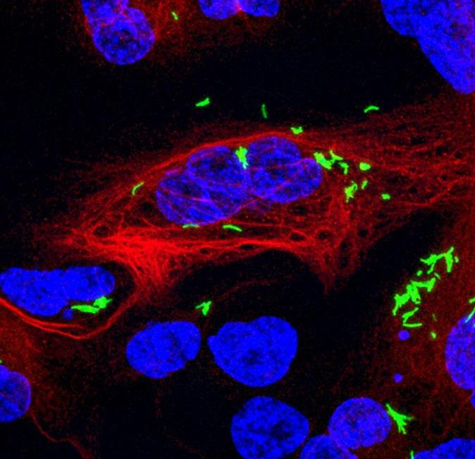 Tuberculosis Image