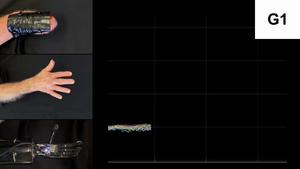 Custom-Fit Prosthetic Hand