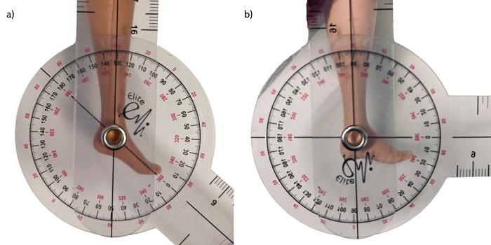 Flat out Fabulous: How Barbie’s foot posture and occupations have changed over the decades, and the lessons we can learn