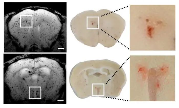Novel Mouse Model of Cerebral Microbleeds