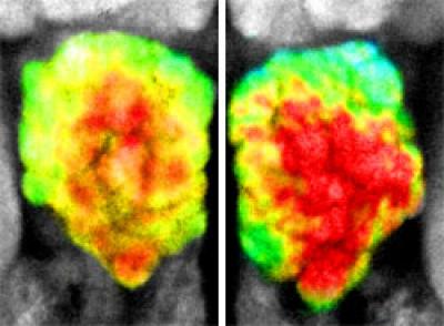 The Plasticity of Smell
