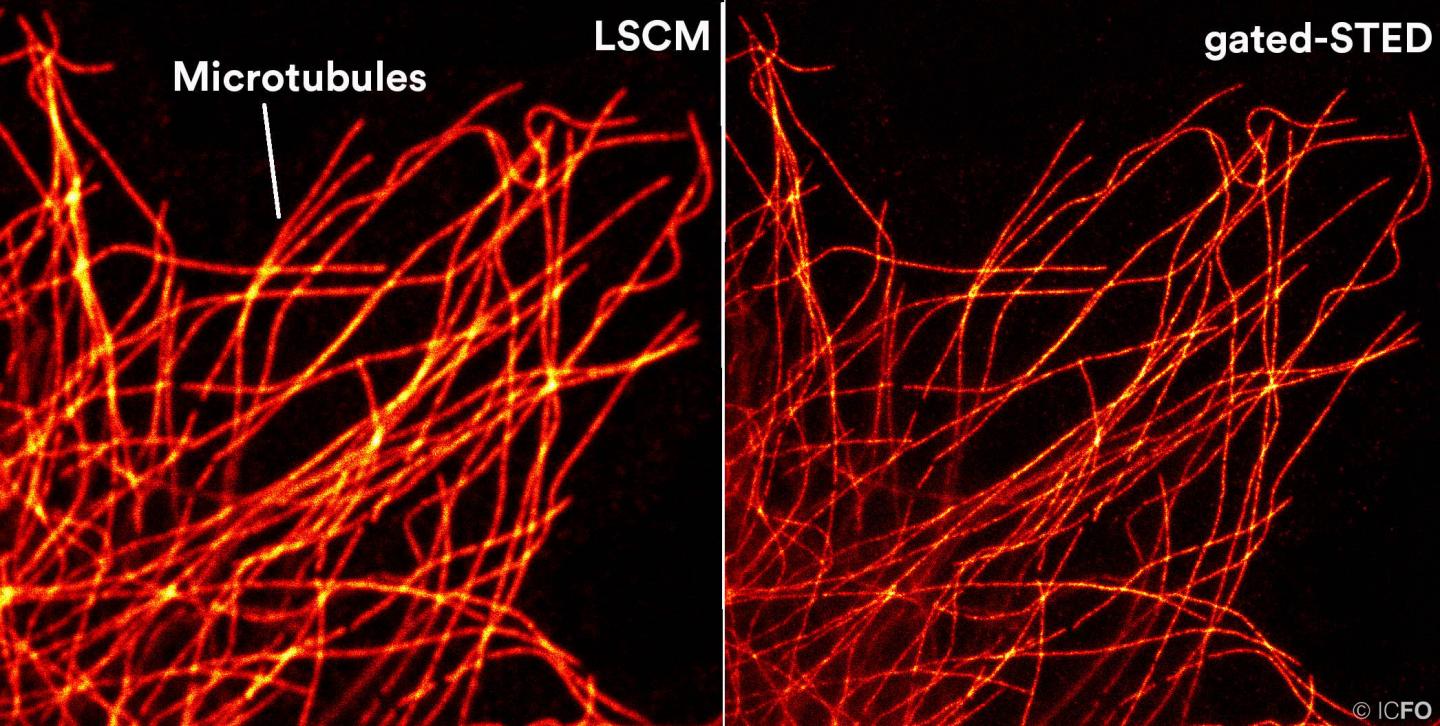 Microtubules Imaging Acquired with New Leica TCS SP8 STED 3X Microscope