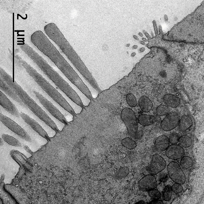 Hair cell of a crocodile magnified around 5000 times