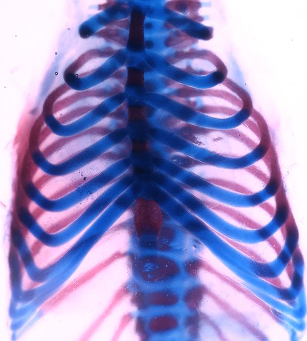 Ribs