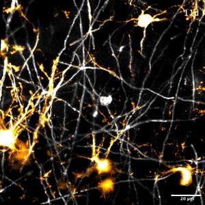 Oligodendrocyte death