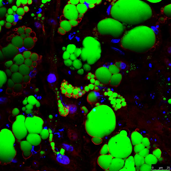 Fat Cells