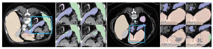 Detailed visualization of the proposed method compared with the recently popular medical segmentation methods (e.g., MISSFormer and Swin-UNet) on the synapse dataset.