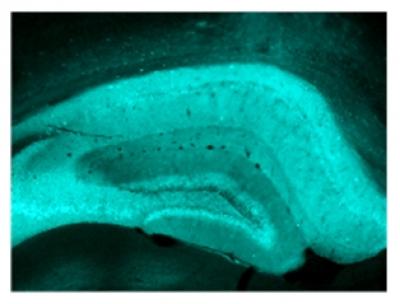 Hippocampus