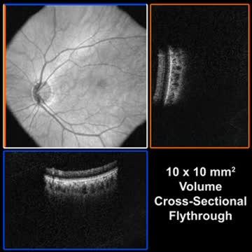 OCT Cross Sectional Images