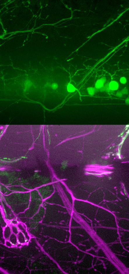 Zebrafish Nerves