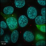 The Microprotein 'NoBody'