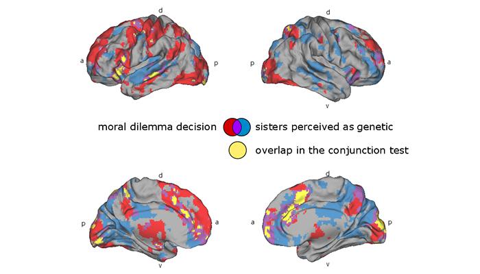 Brain Activity of Study Subjects